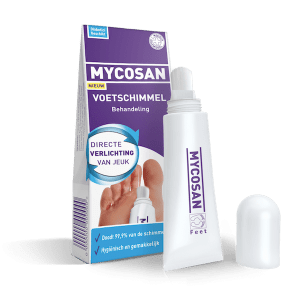 Voetschimmel Behandeling