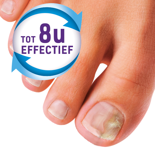 Mycosan Kalknagel Pleister