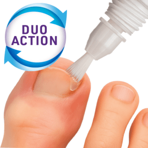 Mycosan Ingegroeide Teennagel Verzorging