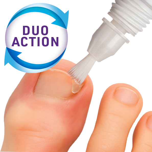 De unieke Precisie kwast van Mycosan Ingegroeide Teennagel Verzorging bereikt de nagelrand en ook onder de nagel