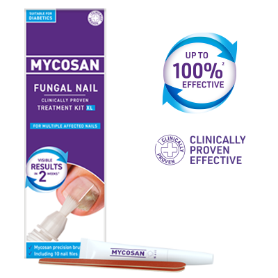 Mycosan Fungal Nail Treatment Kit XL for the targeted treatment of multiple fungal nails